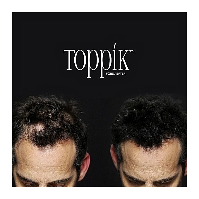 Toppik: Hide Hair Voids and Natural Anti Hair Loss Made of TOPPIK Keratin  Protein for Men and Women | Yalaho Market